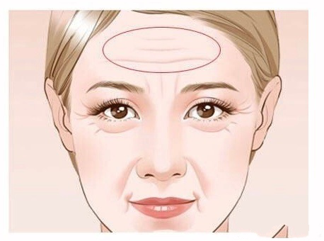 ?年紀輕輕?有了抬頭紋？